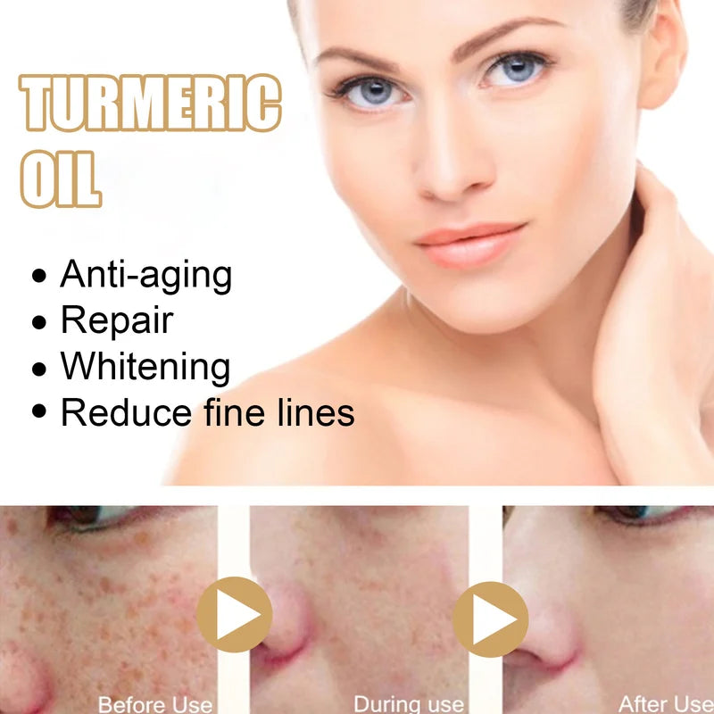 Turmeric Dark Spot Corrector Serum - Fast Acting Serum