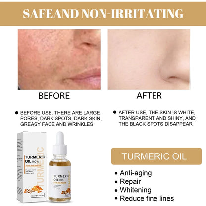 Turmeric Dark Spot Corrector Serum - Fast Acting Serum