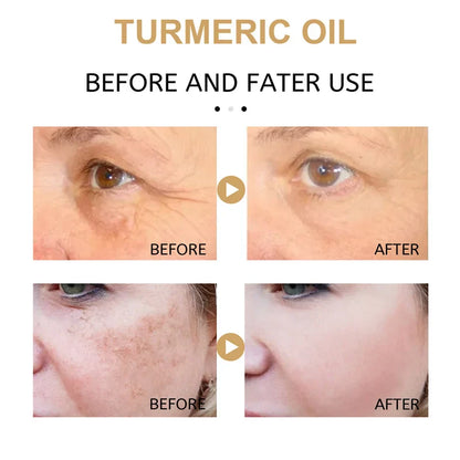 Turmeric Dark Spot Corrector Serum - Fast Acting Serum